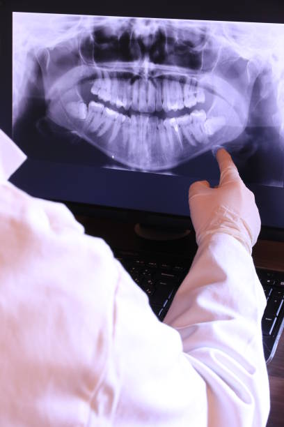 Best Emergency Treatment for Jaw Pain or Injury in Cayce, SC
